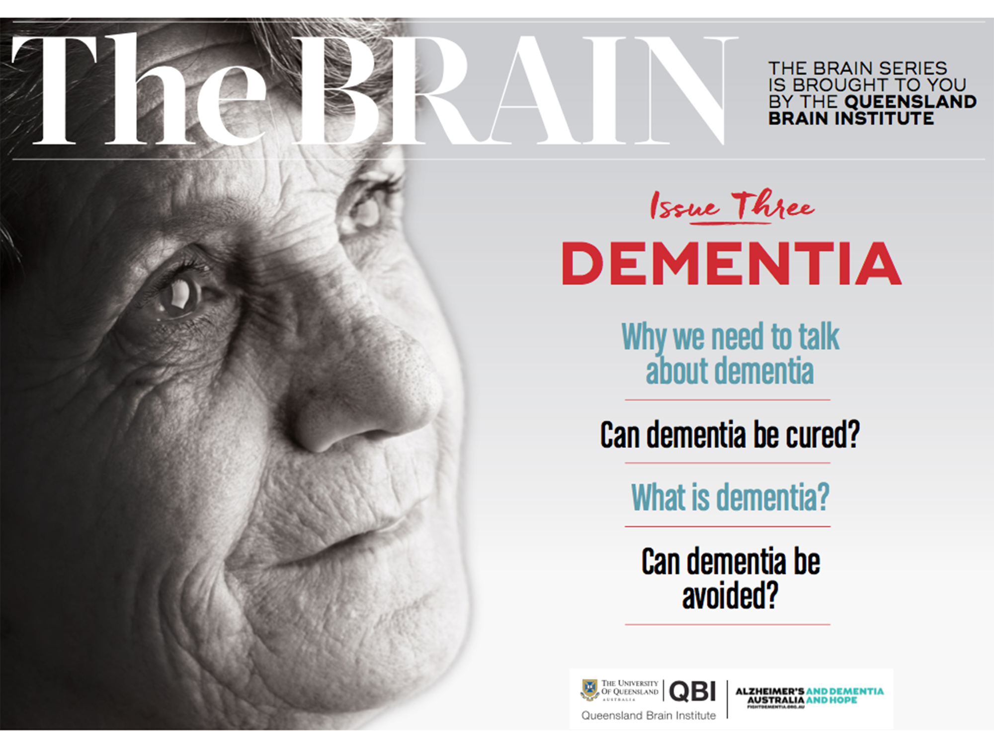 new research dementia alzheimer's